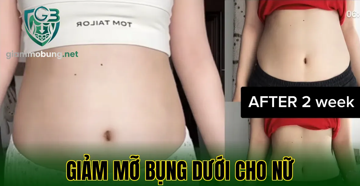 GIẢM MỠ BỤNG DƯỚI CHO NỮ